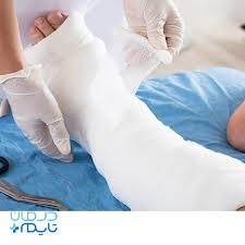 تصویر 3 از خرید و قیمت باند گچی ارتوپدی + فروش عمده